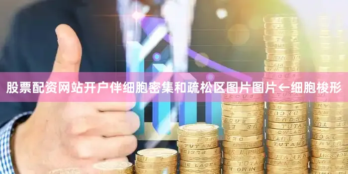 股票配资网站开户伴细胞密集和疏松区图片图片←细胞梭形